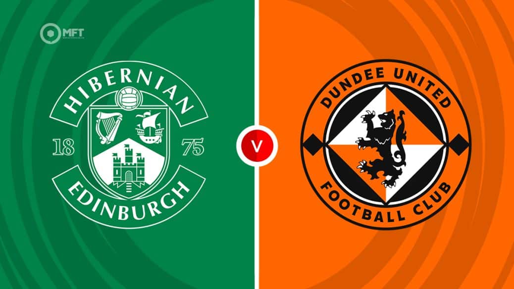Hibernian v Dundee United Hibs v Dundee Utd Hibs v Dundee United